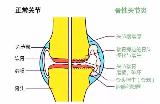 正常膝关节示意图