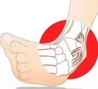 崴脚