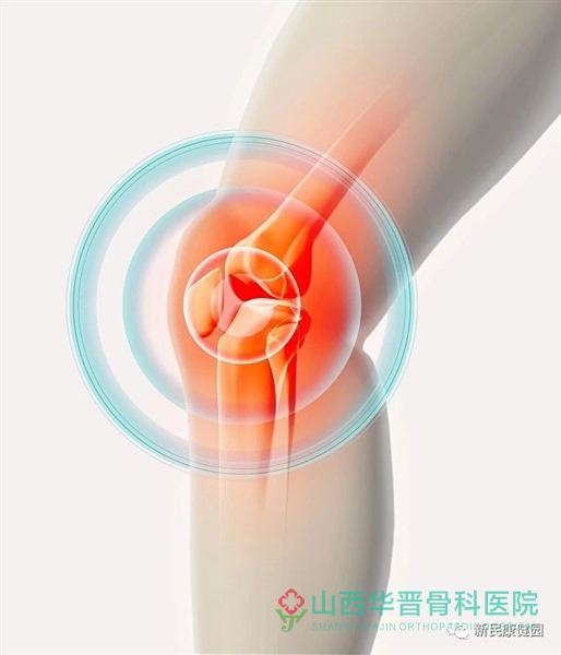 全膝关节置换术